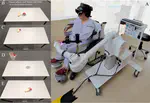To Reach the Unreachable: Exploring the Potential of VR Hand Redirection for Upper Limb Rehabilitation